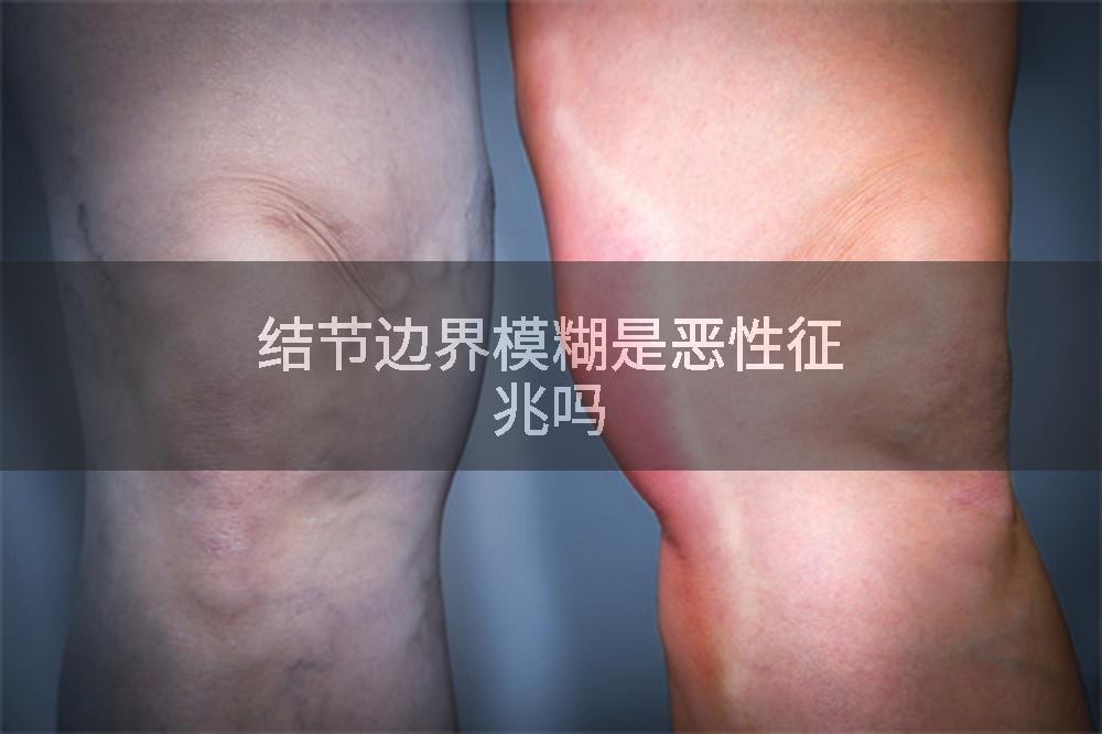 结节边界模糊是恶性征兆吗