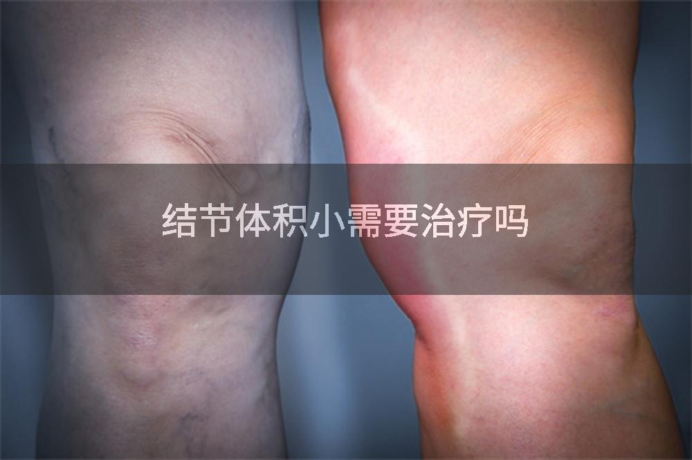 结节体积小需要治疗吗