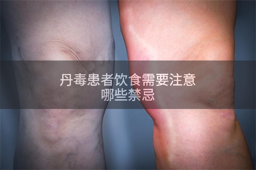 丹毒患者饮食需要注意哪些禁忌