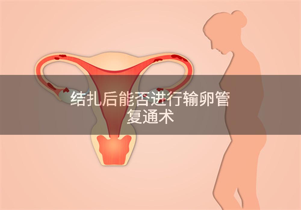 结扎后能否进行输卵管复通术