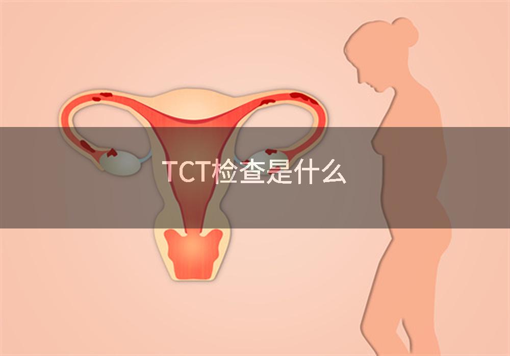 TCT检查是什么