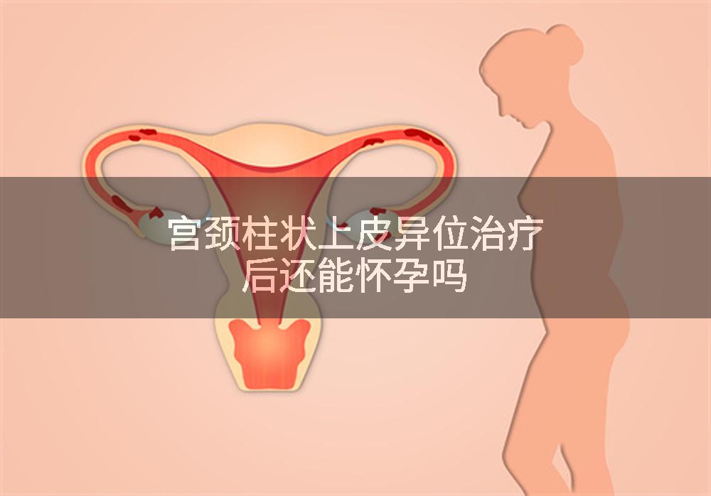 宫颈柱状上皮异位治疗后还能怀孕吗