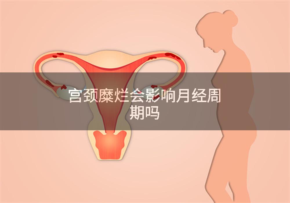 宫颈糜烂会影响月经周期吗