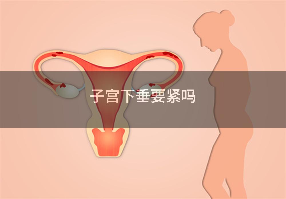 子宫下垂要紧吗