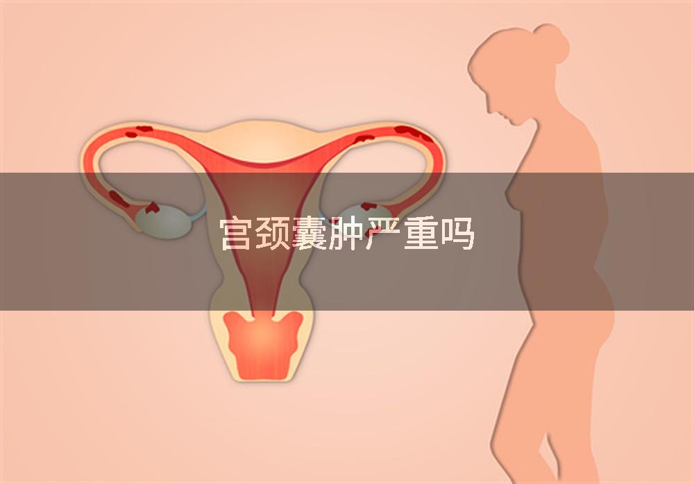 宫颈囊肿严重吗