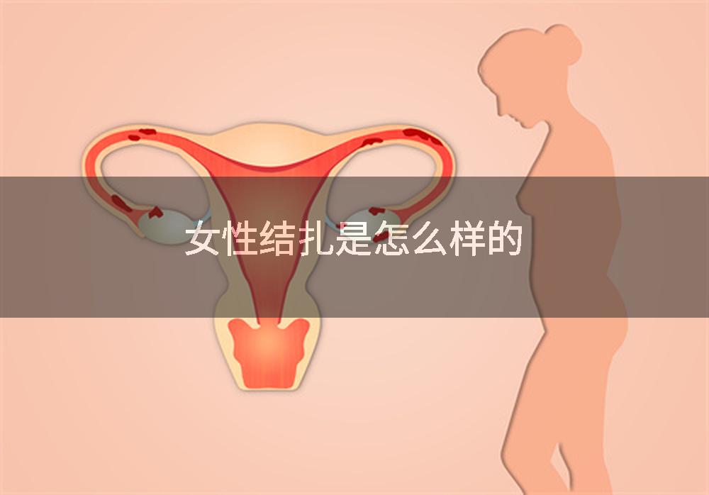 女性结扎是怎么样的