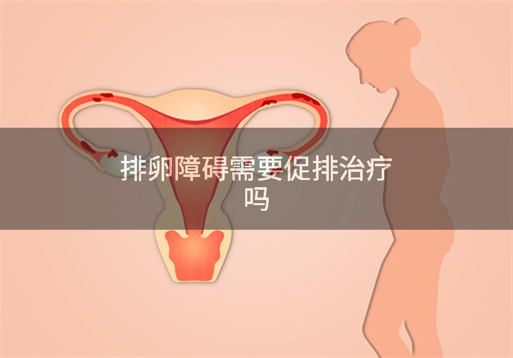排卵障碍需要促排治疗吗