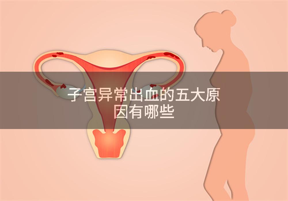 子宫异常出血的五大原因有哪些