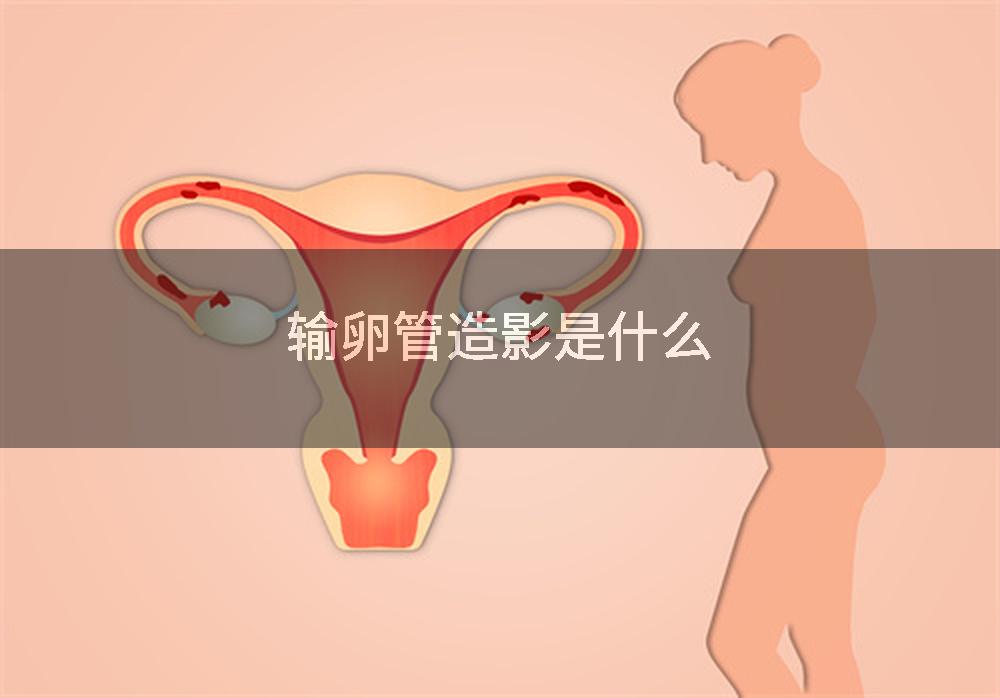 输卵管造影是什么