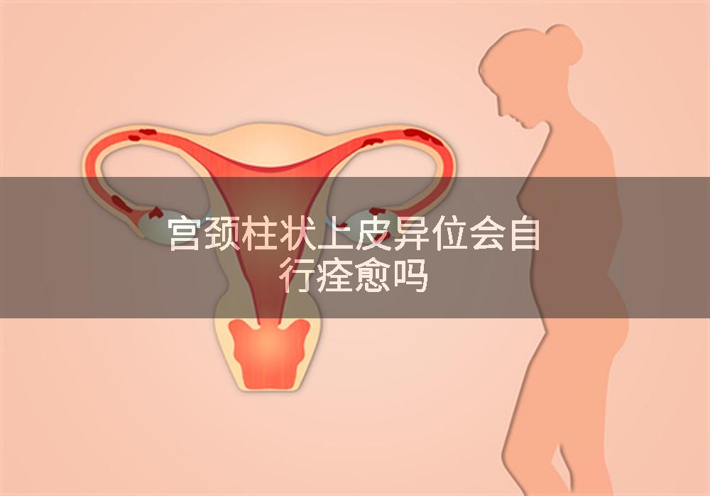 宫颈柱状上皮异位会自行痊愈吗