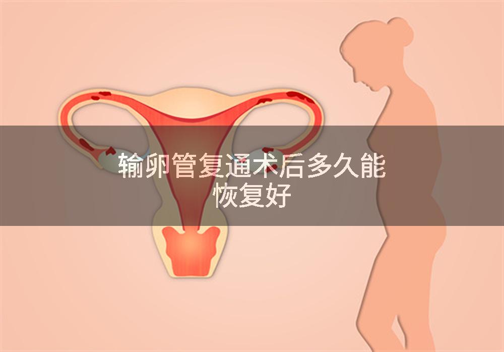 输卵管复通术后多久能恢复好