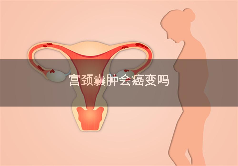 宫颈囊肿会癌变吗