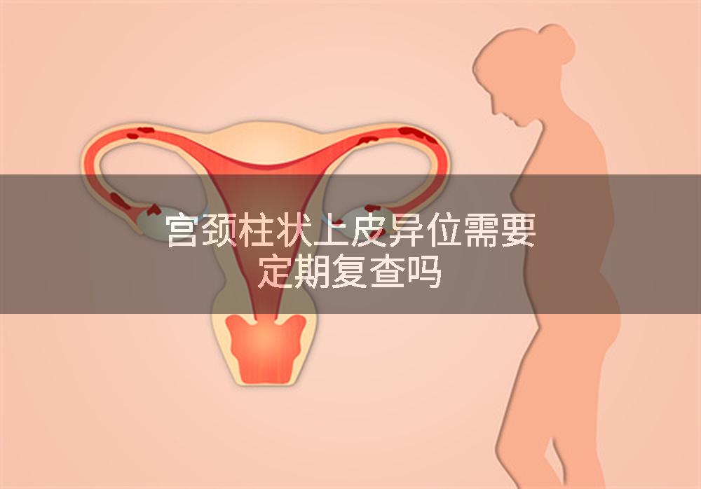 宫颈柱状上皮异位需要定期复查吗