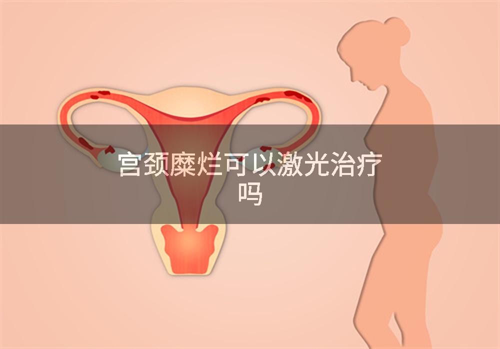 宫颈糜烂可以激光治疗吗