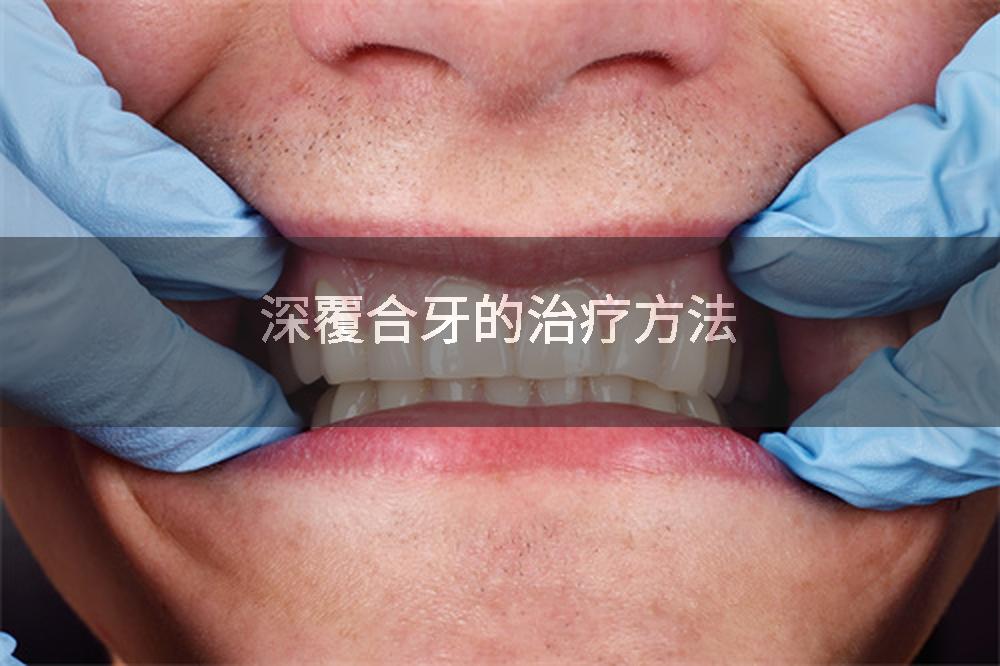 深覆合牙的治疗方法