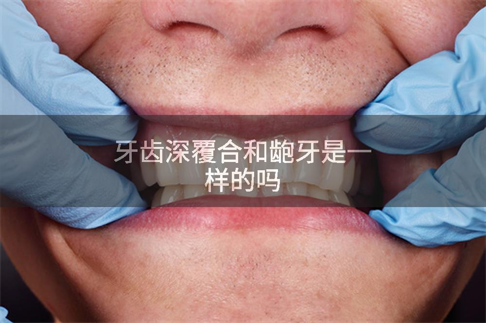 牙齿深覆合和龅牙是一样的吗