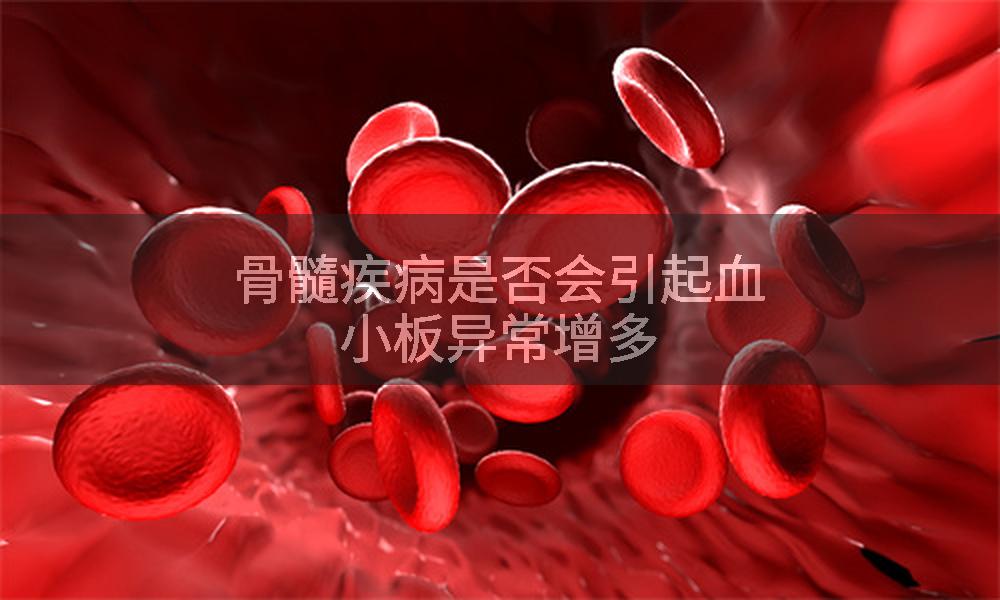 骨髓疾病是否会引起血小板异常增多