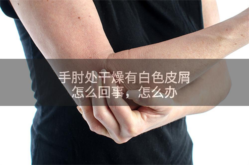手肘处干燥有白色皮屑怎么回事，怎么办