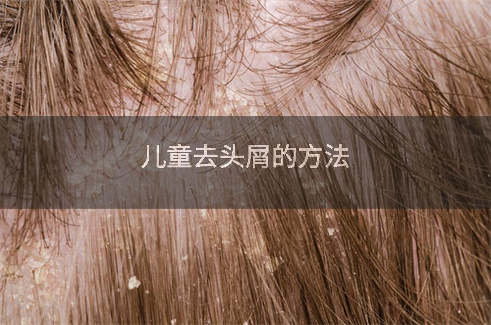 儿童去头屑的方法
