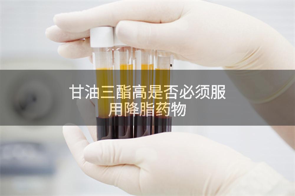甘油三酯高是否必须服用降脂药物