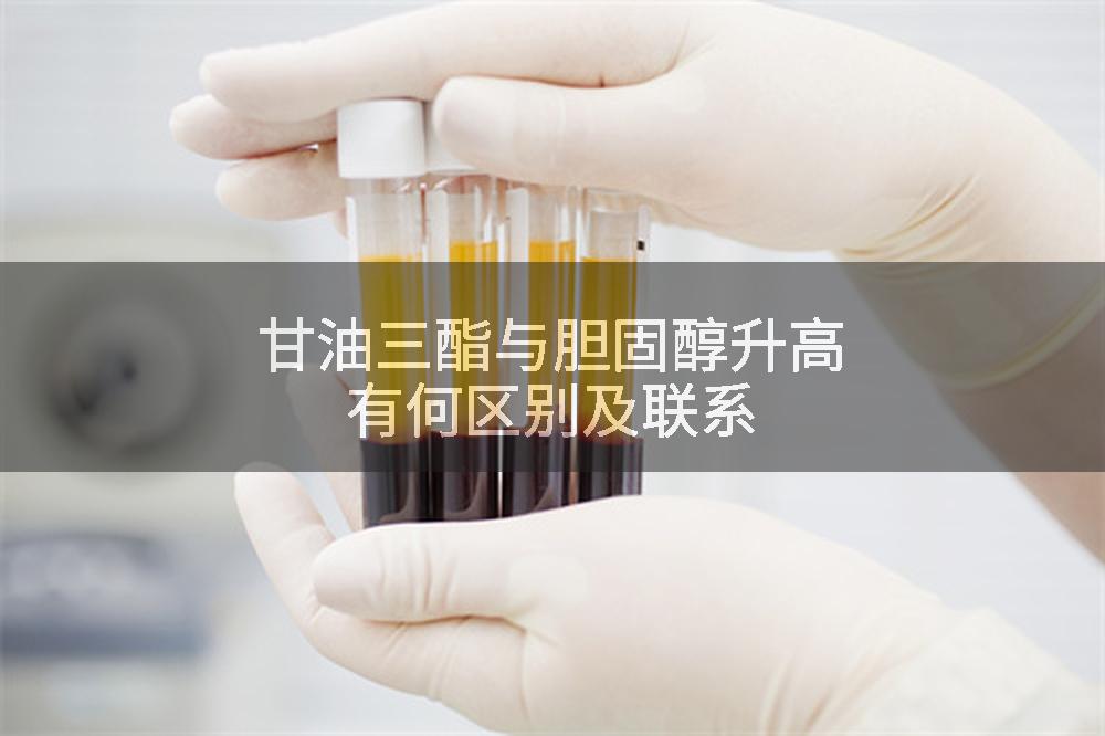 甘油三酯与胆固醇升高有何区别及联系