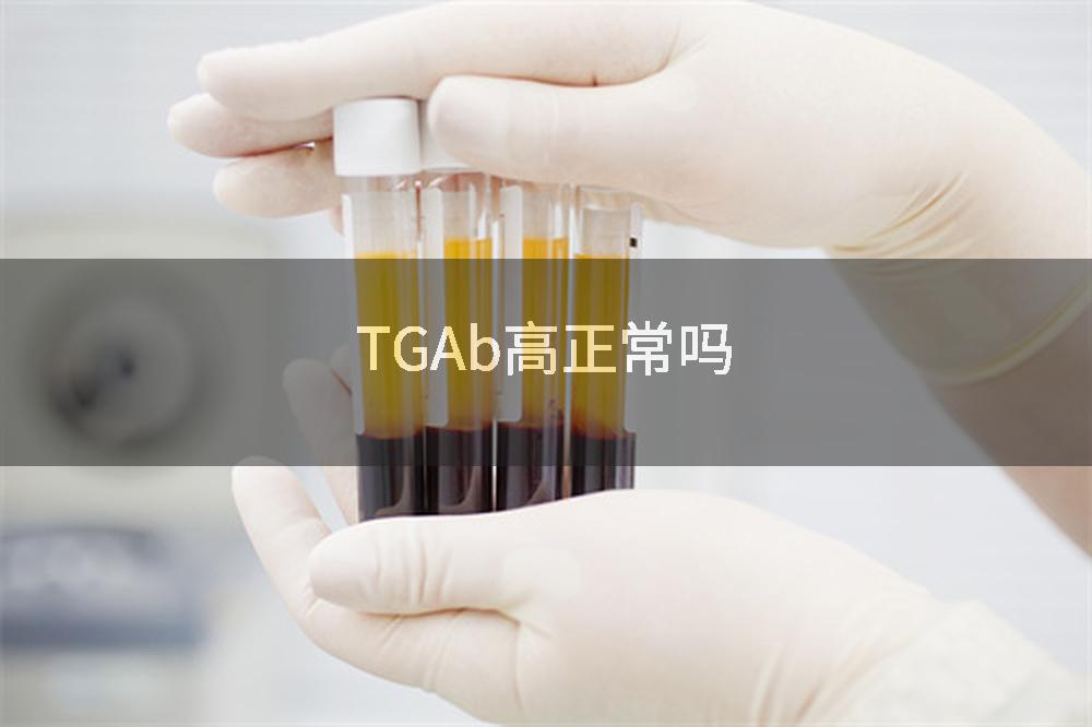 TGAb高正常吗