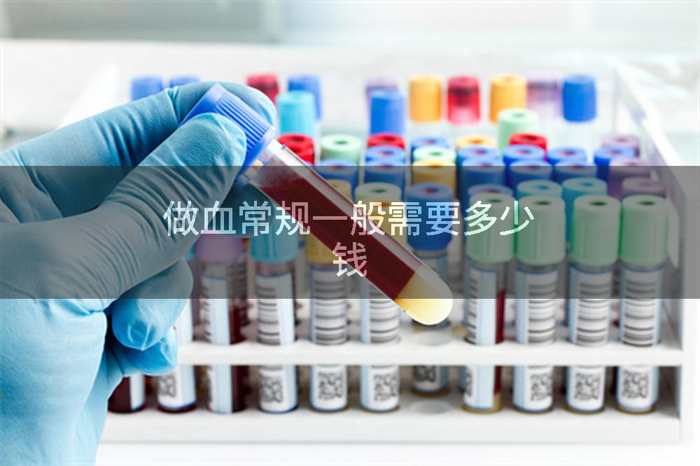 做血常规一般需要多少钱