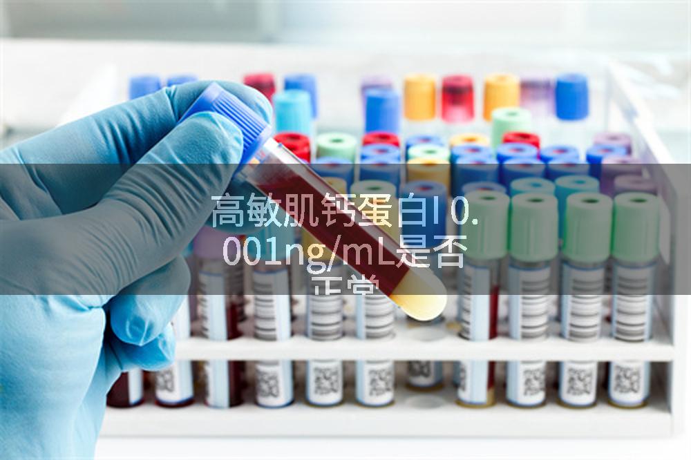 高敏肌钙蛋白I 0.001ng/mL是否正常
