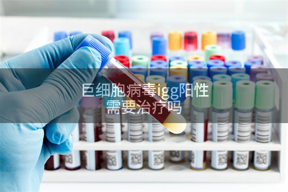巨细胞病毒igg阳性需要治疗吗