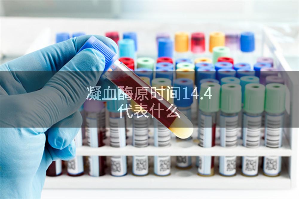 凝血酶原时间14.4代表什么