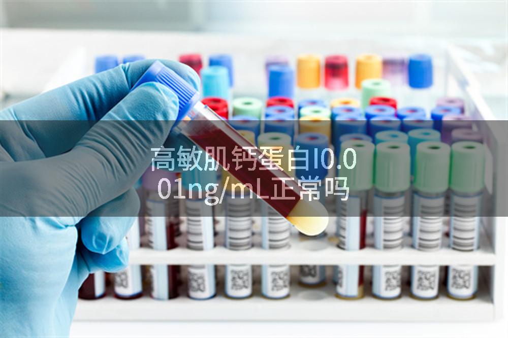 高敏肌钙蛋白I0.001ng/mL正常吗