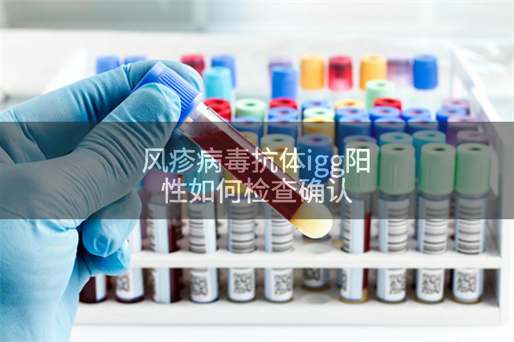 风疹病毒抗体igg阳性如何检查确认