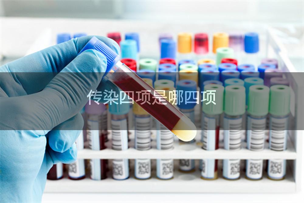 传染四项是哪四项