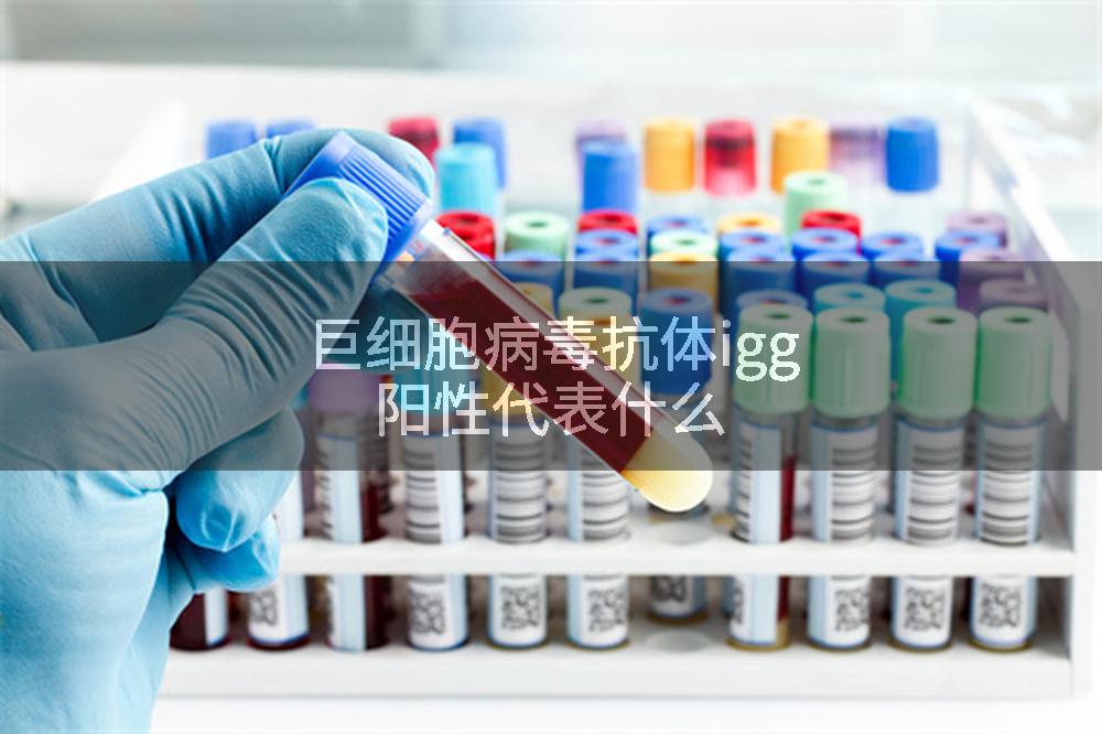 巨细胞病毒抗体igg阳性代表什么