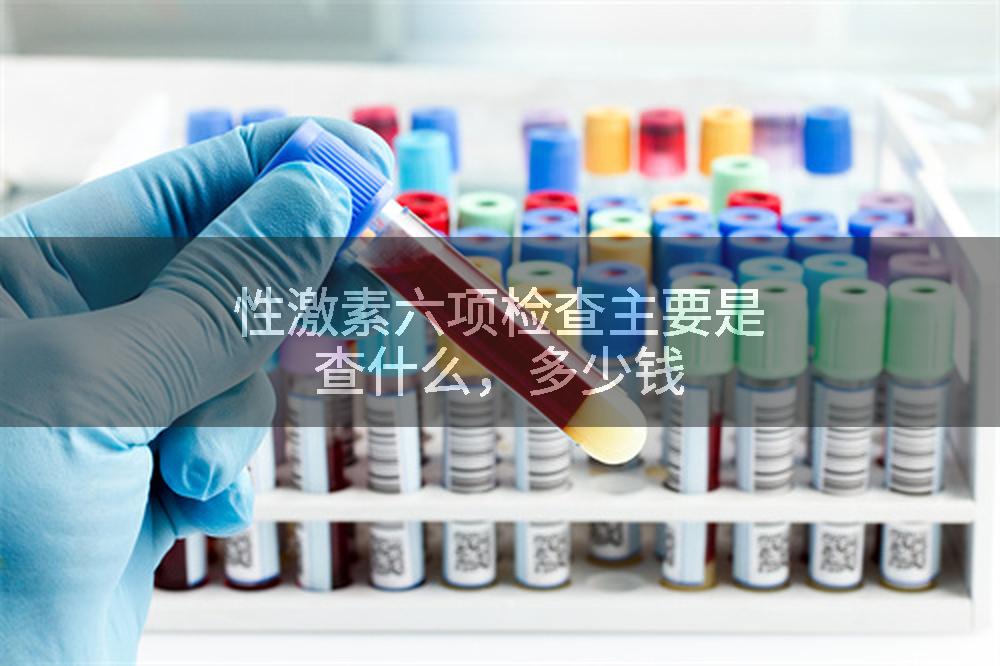 性激素六项检查主要是查什么，多少钱