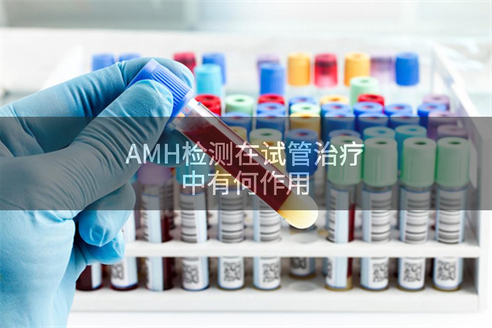 AMH检测在试管治疗中有何作用