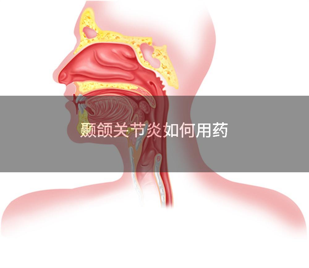 颞颌关节炎如何用药