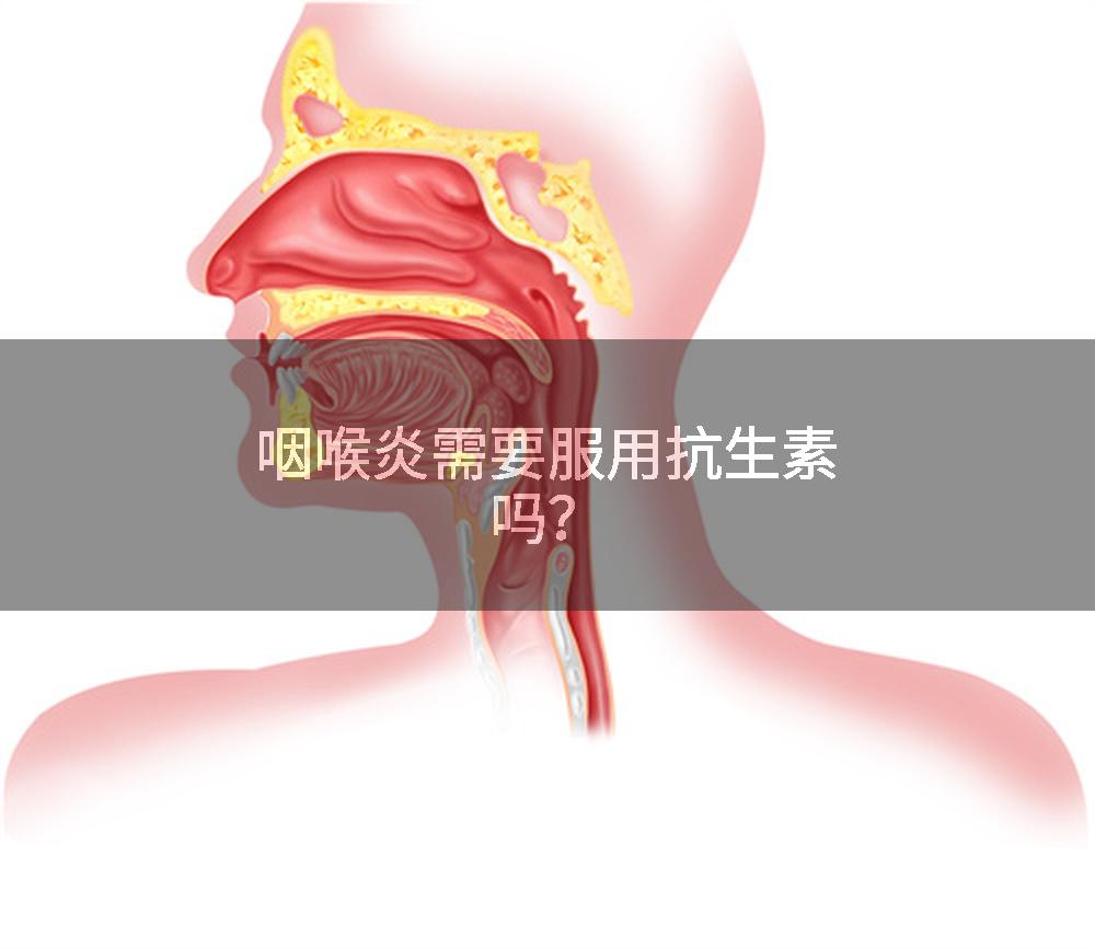 咽喉炎需要服用抗生素吗？