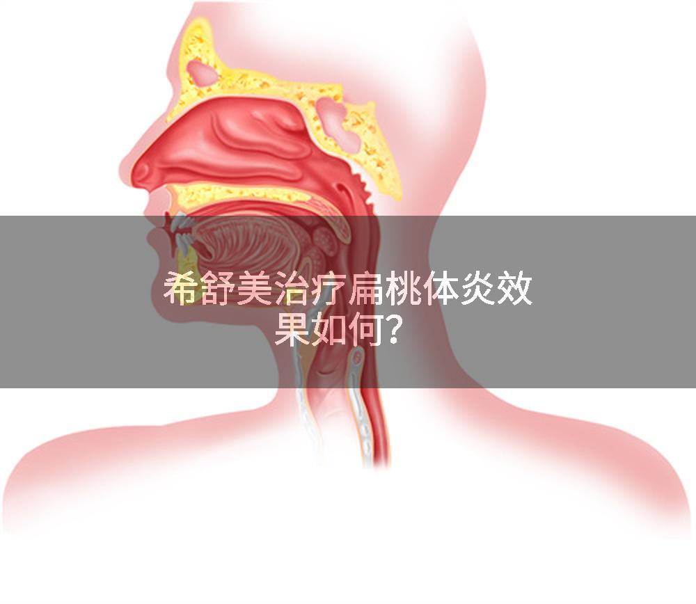 希舒美治疗扁桃体炎效果如何？