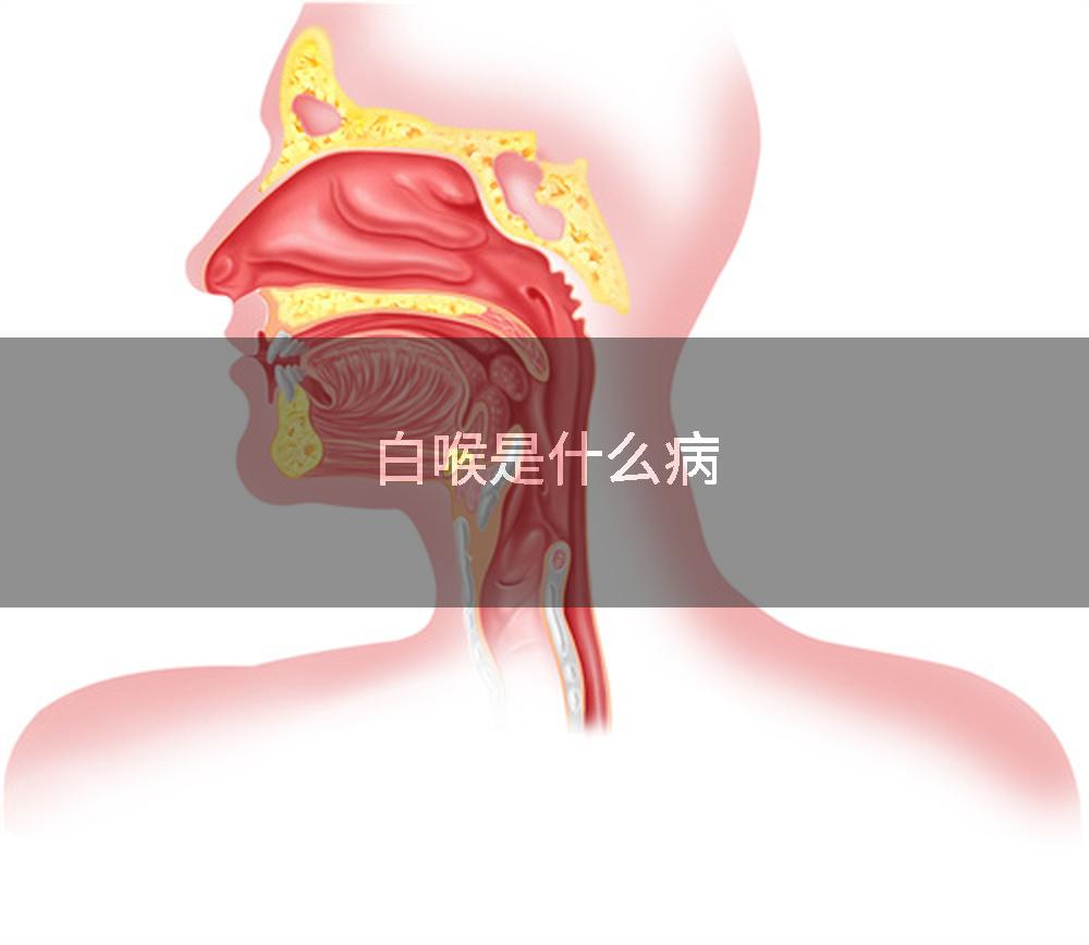 白喉是什么病
