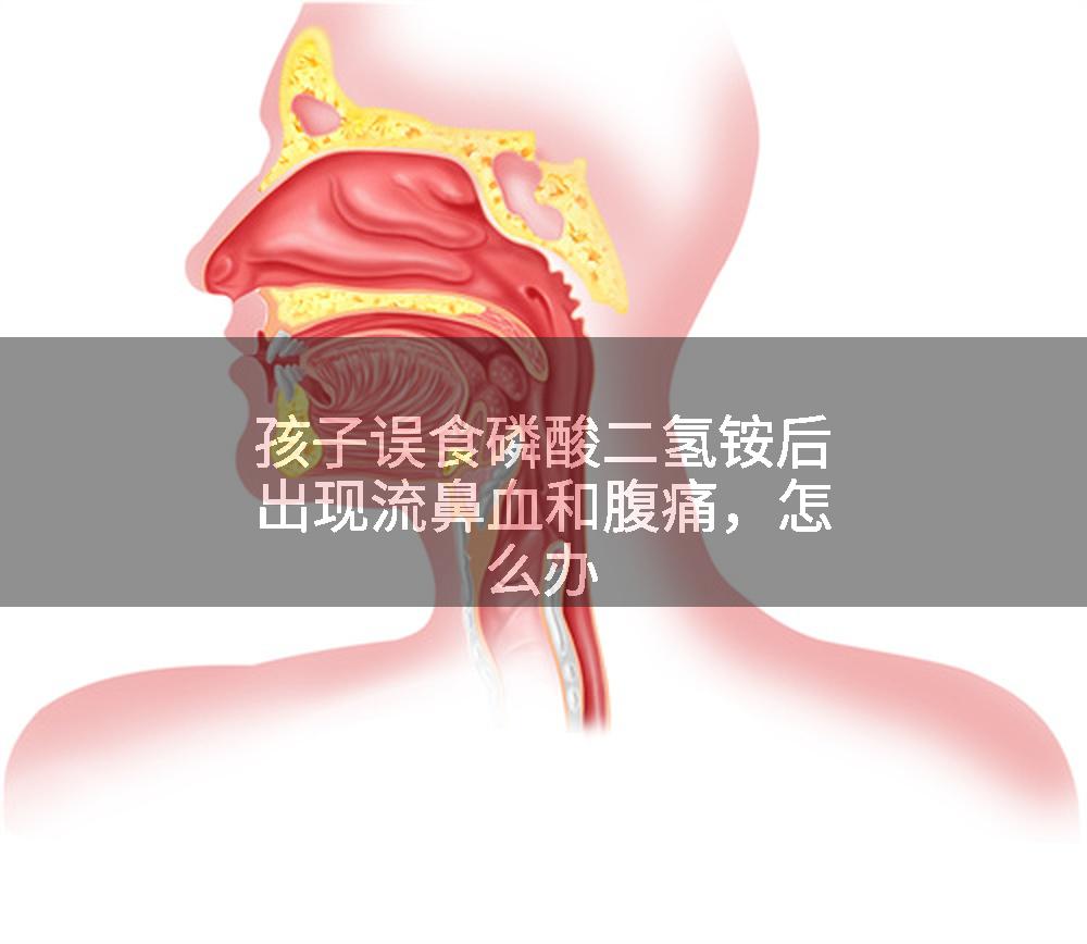 孩子误食磷酸二氢铵后出现流鼻血和腹痛，怎么办