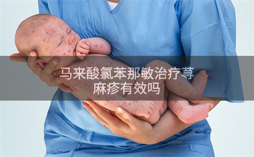 马来酸氯苯那敏治疗荨麻疹有效吗