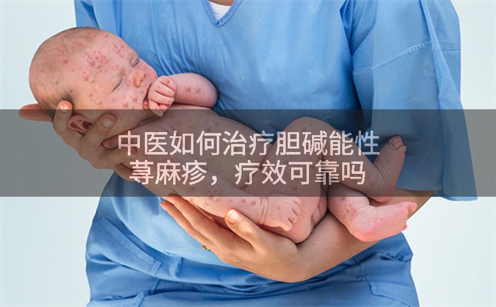 中医如何治疗胆碱能性荨麻疹，疗效可靠吗