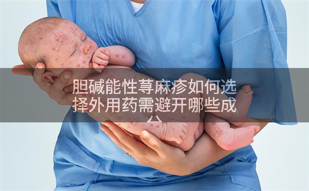 胆碱能性荨麻疹如何选择外用药需避开哪些成分
