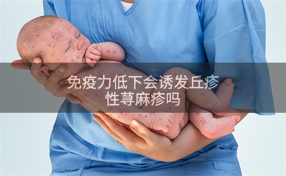 免疫力低下会诱发丘疹性荨麻疹吗