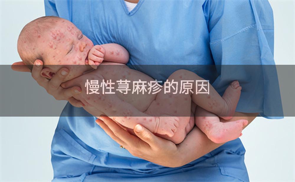 慢性荨麻疹的原因