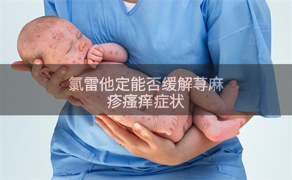氯雷他定能否缓解荨麻疹瘙痒症状