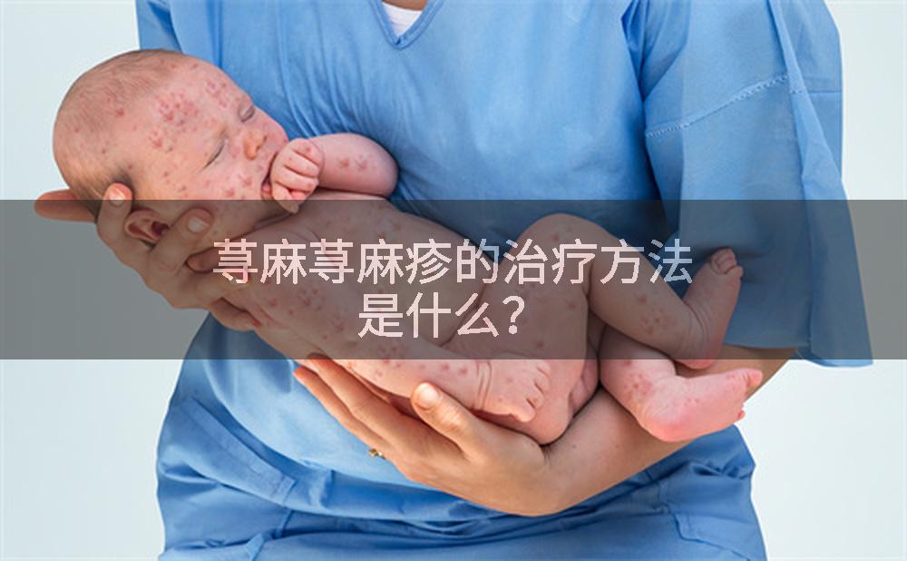 荨麻荨麻疹的治疗方法是什么？