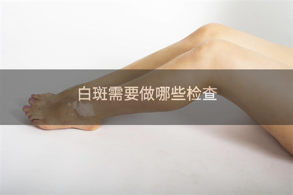 白斑需要做哪些检查