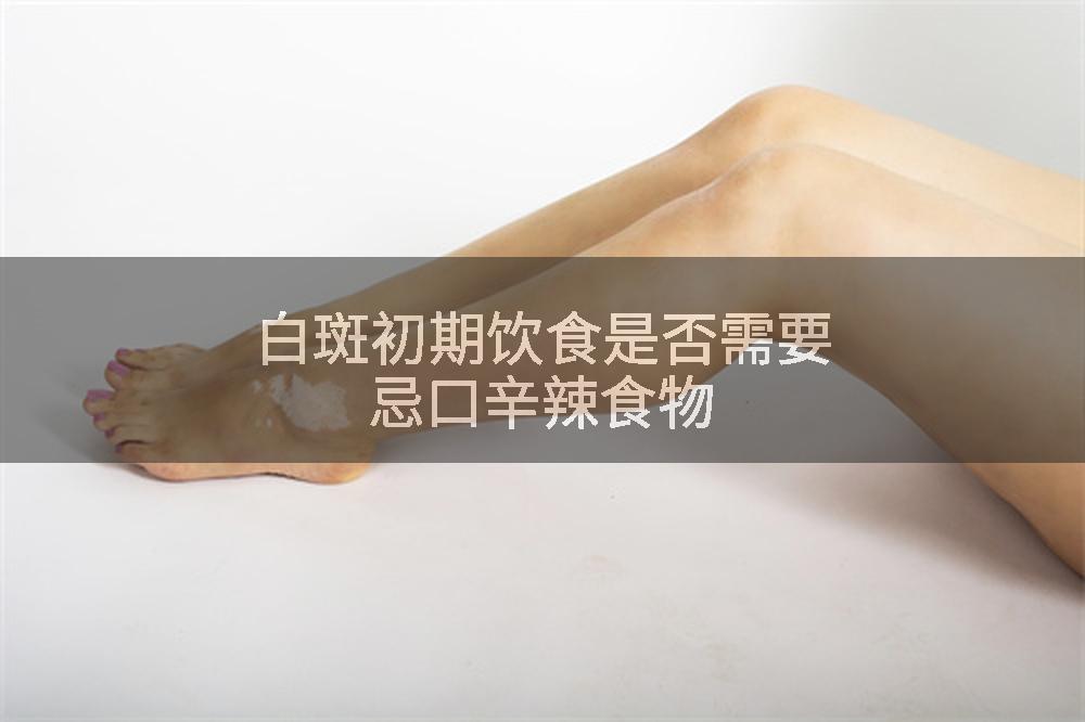 白斑初期饮食是否需要忌口辛辣食物